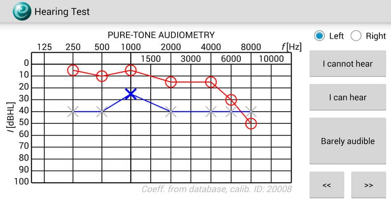 hearing test e audiologia1