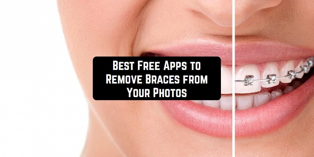 9 Free Apps To Remove Braces From Your Photos Android Ios Free Apps For Android And Ios