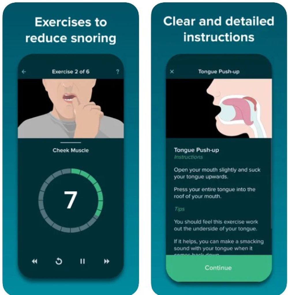 SnoreGym: Reduce Your Snoring1