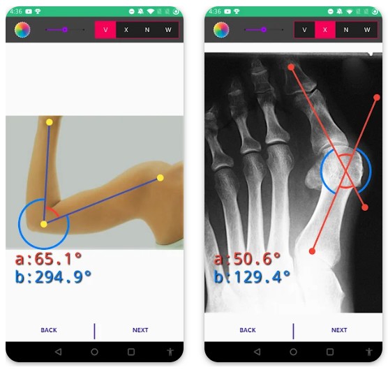 Angulus: Measure angles on ima1