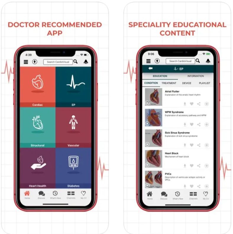 7 Free ECG Apps for Android & iOS | Freeappsforme - Free apps for ...