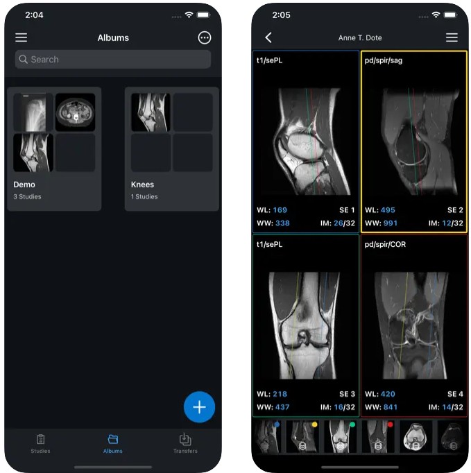 IDV - IMAIOS DICOM Viewer1